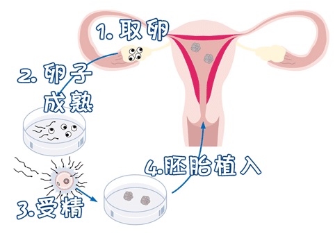 IVF实验室